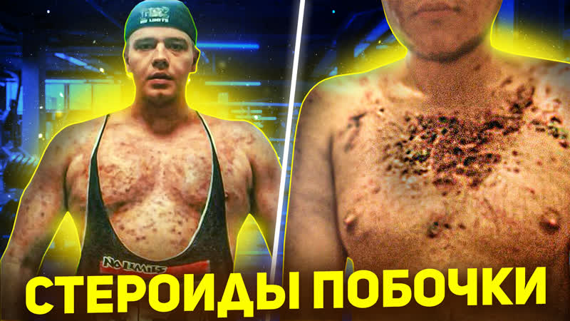 ВЛАД ХОТЕЛ СТАТЬ КАЧКОМ, НО СГНИЛ