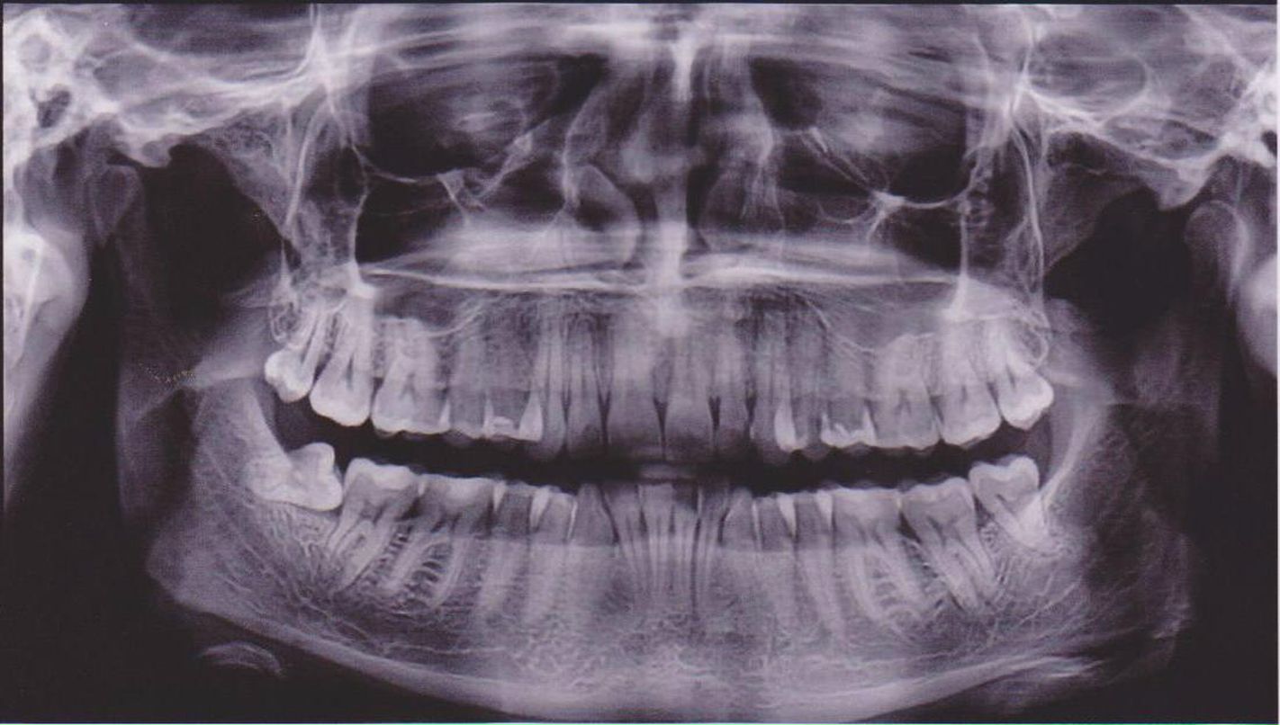 Виталий Горб | Киев