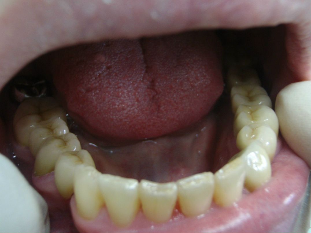 Эрнест Абрамян | Москва